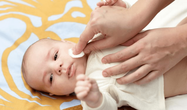 Menghilangkan ruam susu pada bayi