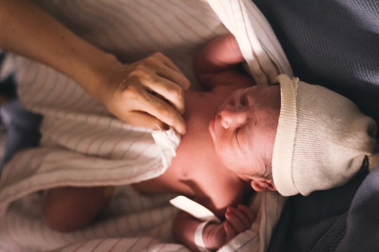 kelainan kongenital pada bayi baru lahir (1)